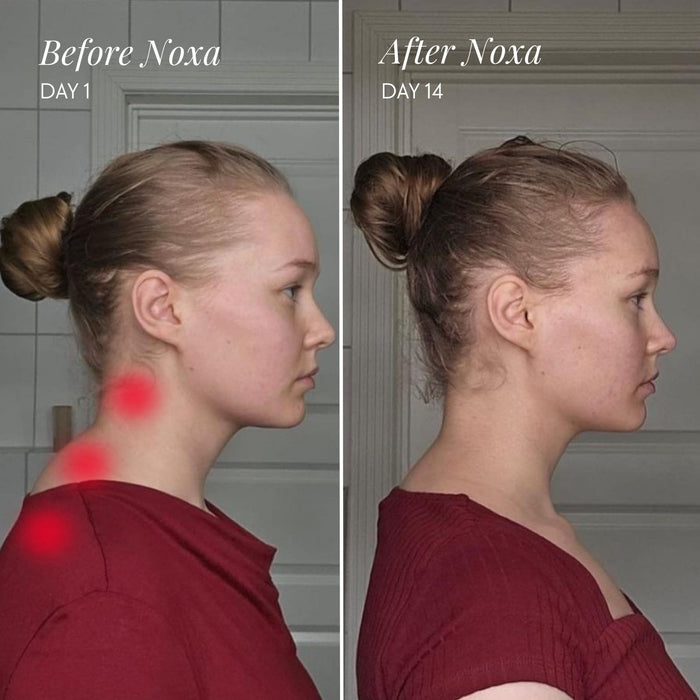 ThermaRelief Neck & Shoulder Massager